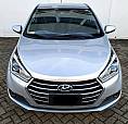 Hyundai Hb20S 1.6