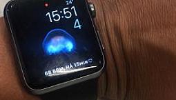 Apple Watch Séries 1